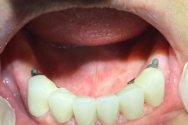 Gönen Özel Dt.Hale Karlıca Diş Kliniği - Resim 10