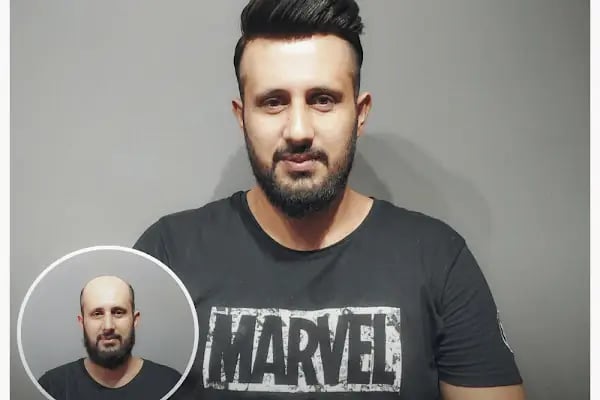 Magic Hair Protez Saç Merkezi - Resim 1