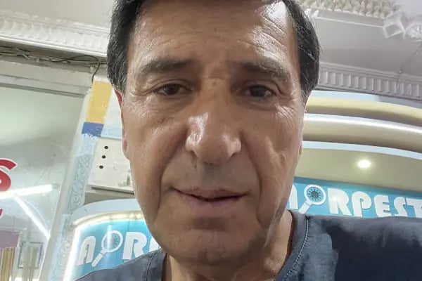 Lena Health Hairtransplant Turkey - Resim 20