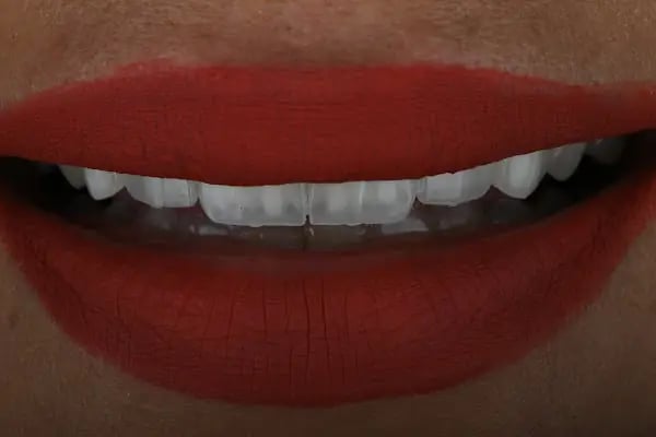 Dent Km - Buca Diş Kliniği - Resim 19