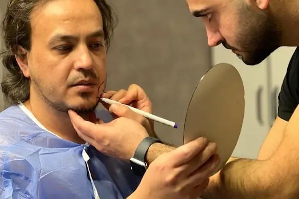 Este Farya Clinic | Saç Ekim Merkezi - Resim 4