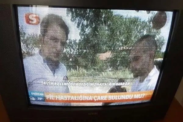 Malatya Fizyoterapist DR.Fzt.Gökhan Aygül / Denge Fizyoterapi ve Rehabilitasyon Merkezi/ - Resim 14