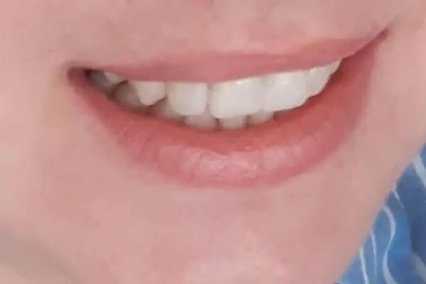 Diş Doktorum Ağız ve Diş Sağlığı Polikliniği - Resim 12