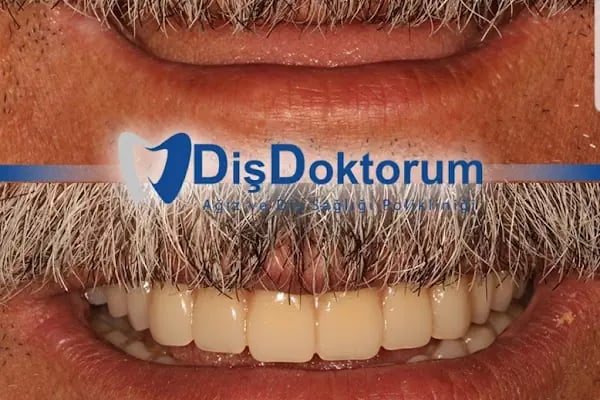 Diş Doktorum Ağız ve Diş Sağlığı Polikliniği - Resim 15