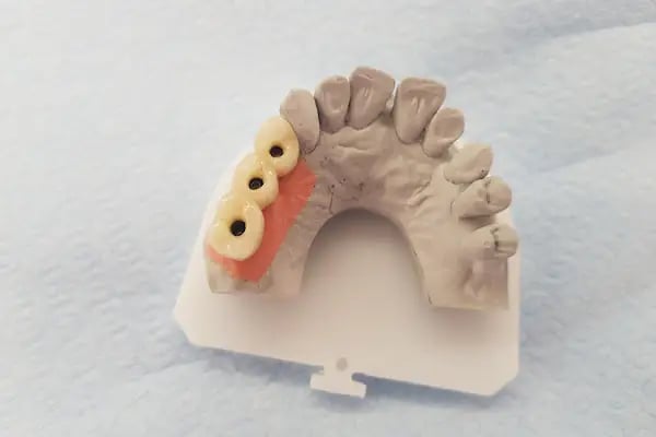 Diş Doktorum Ağız ve Diş Sağlığı Polikliniği - Resim 4