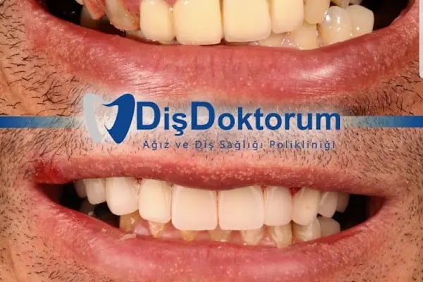 Diş Doktorum Ağız ve Diş Sağlığı Polikliniği - Resim 16