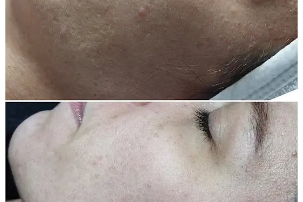 Feyza Benli Beauty Center - Resim 4