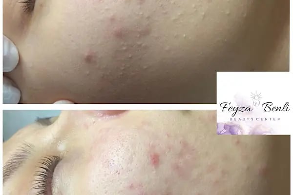 Feyza Benli Beauty Center - Resim 5