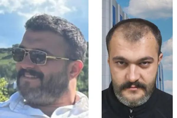 Güneydoğu Saç Ekimi - Resim 9