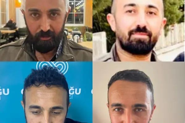 Güneydoğu Saç Ekimi - Resim 7