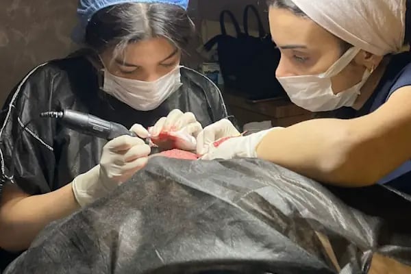 SHOWMED TURKEY Saç Ekimi ve Tedavilerİ - Resim 3