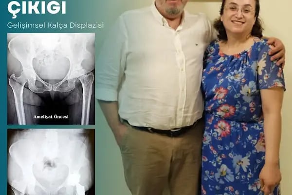 Prof. Dr. Hasan Hilmi Muratlı | Ortopedi ve Travmatoloji Uzmanı - Marmara - Resim 19