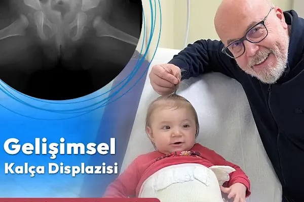 Prof. Dr. Hasan Hilmi Muratlı | Ortopedi ve Travmatoloji Uzmanı - Marmara - Resim 9