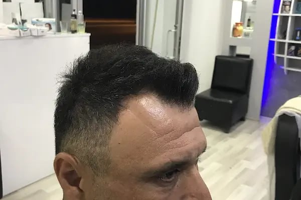 Sinan Ak hair - Resim 18