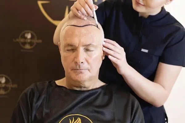 Land Of Hair - Hair Transplant Center / Istanbul Hair Transplant Center in Turkey - Resim 5