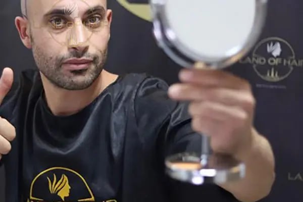Land Of Hair - Hair Transplant Center / Istanbul Hair Transplant Center in Turkey - Resim 10