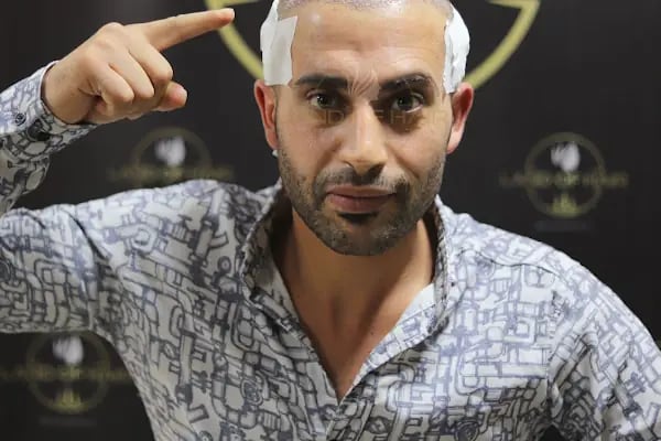 Land Of Hair - Hair Transplant Center / Istanbul Hair Transplant Center in Turkey - Resim 18