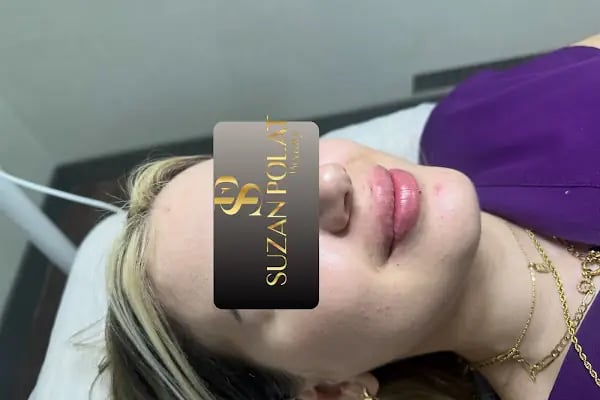 Suzan Polat Beauty - Resim 7