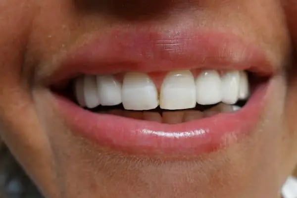 Tandlæge i Tyrkiet, Tandlæge i Alanya. DR. Çağrı AVANAZ - Resim 12