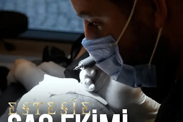 Estesie Clinic | İstanbul Medikal Estetik Merkezi Saç Ekimi Plastik Cerrahi Burun Dolgusu En iyi Naturel Botoks Klinik - Resim 12
