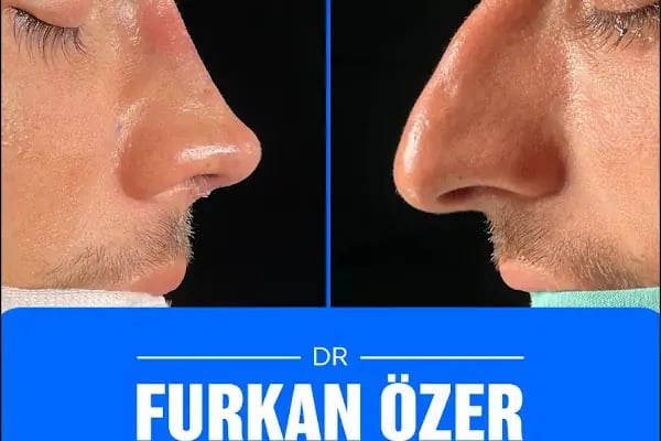 Op.Dr.Furkan Özer - Resim 20