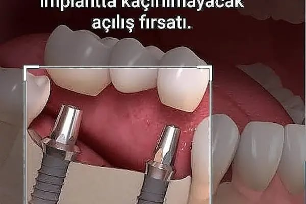 Özel Medidenta Ayrancılar Ağız ve Diş sağlığı Polikliniği - Resim 6