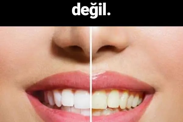 Özel Medidenta Ayrancılar Ağız ve Diş sağlığı Polikliniği - Resim 10