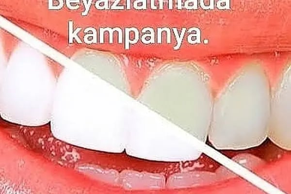 Özel Medidenta Ayrancılar Ağız ve Diş sağlığı Polikliniği - Resim 14
