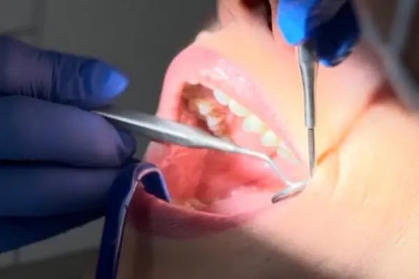 Karacan Dent - İstanbul Diş Kliniği - Istanbul Dental Clinic - Resim 13