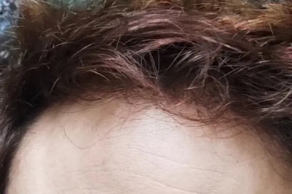 Dr. Özlem Biçer | MD - Resim 17