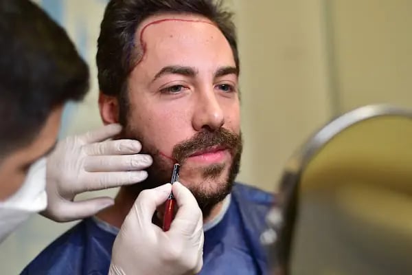 Long Hair Center Istanbul (LHC CLINIC) - Resim 13