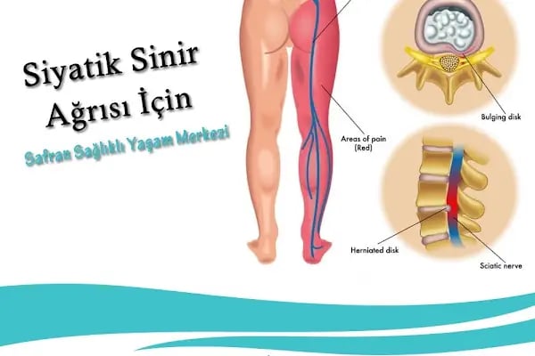 Safran sağlıklı yaşam merkezi GTOS Terapi AKHİSAR Manuel Terapi Fizyoterapi - Resim 7
