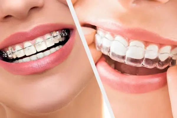 Özel Ankara Mavi Ağız ve Diş Sağlığı Polikliniği Etimesgut Şubesi - Resim 5