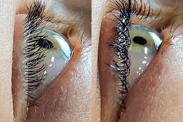 İvente Beauty Çayyolu Güzellik Merkezi,Bölgesel Zayıflama,cilt bakımı,lazer epilasyon - Resim 19