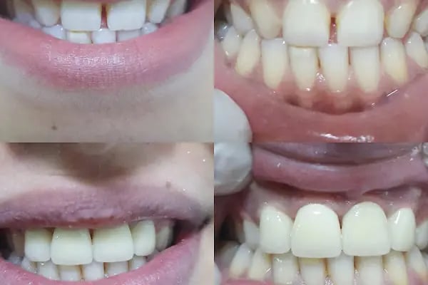 Nehir Ağız Ve Diş Sağlığı Polikliniği - Resim 14