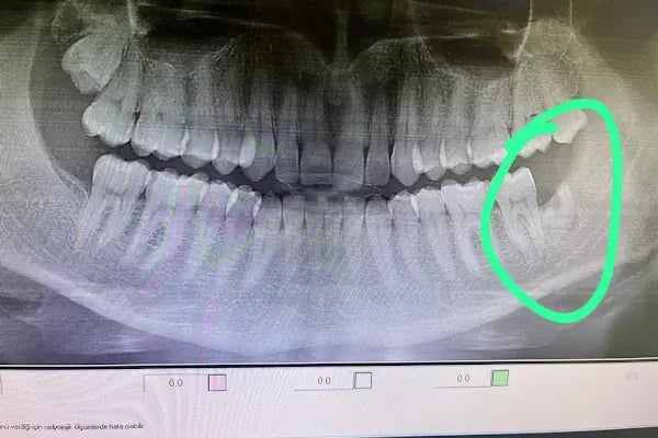 Özel Avcılar Avrasya Ağız ve Diş Sağlığı Polikliniği - Resim 9