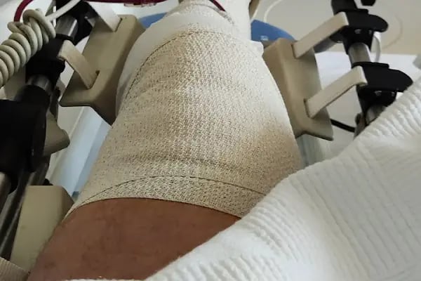 Op. Dr. Murat Kezer(Kalça&amp;Diz Protezi, Halluks Valgus, Robotik Diz Protezi, Protez Revizyonu, Artroskopi) - Resim 19