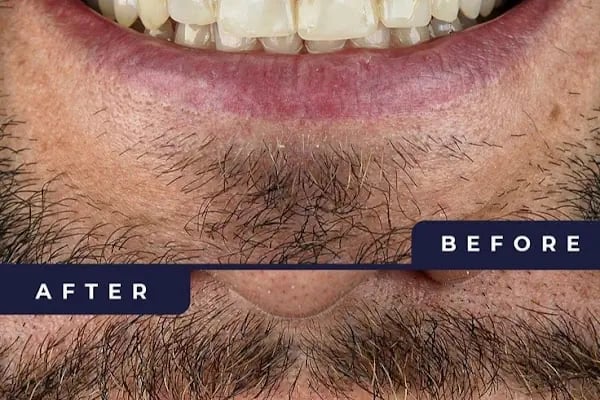 DentFita - Resim 6