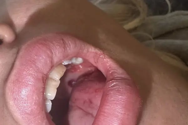 DentFita - Resim 5