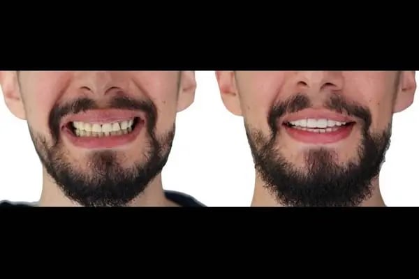 Positive Dental Studio - Resim 12