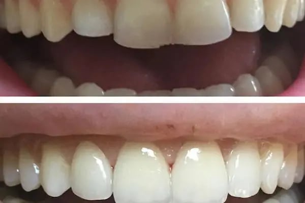 Positive Dental Studio - Resim 3