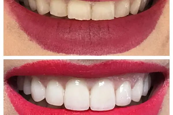 Positive Dental Studio - Resim 4