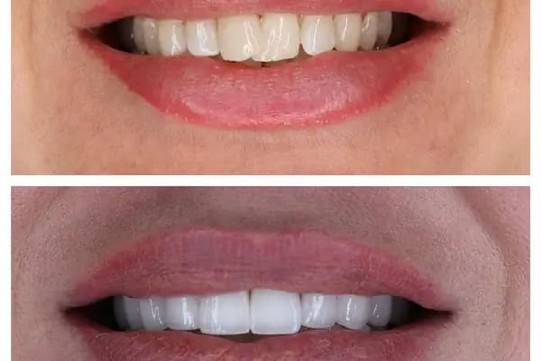 Positive Dental Studio - Resim 16