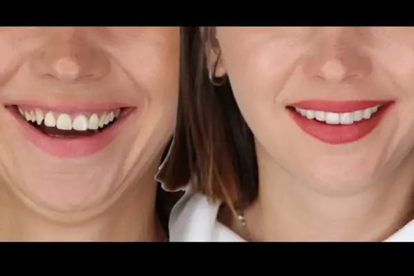 Positive Dental Studio - Resim 14