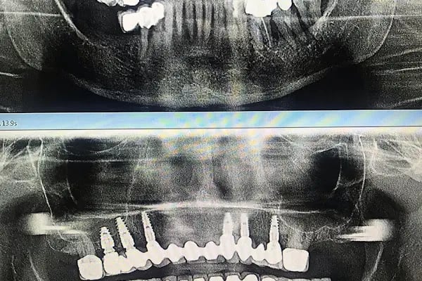 Positive Dental Studio - Resim 2