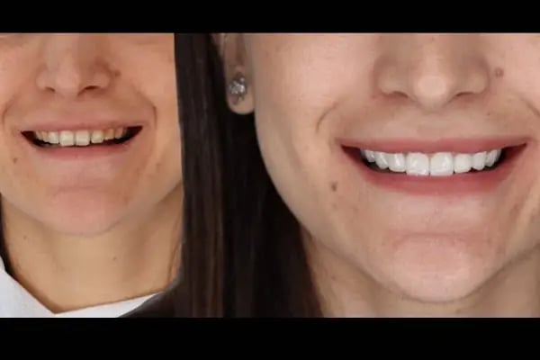 Positive Dental Studio - Resim 13