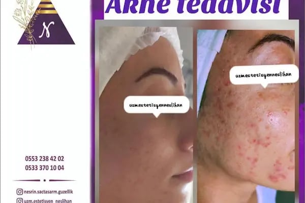 P&F Beauty Time Estetik ve Güzellik - Resim 15