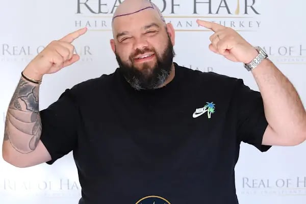 Real Of Hair - Hair Transplant Center in Turkey - Resim 20