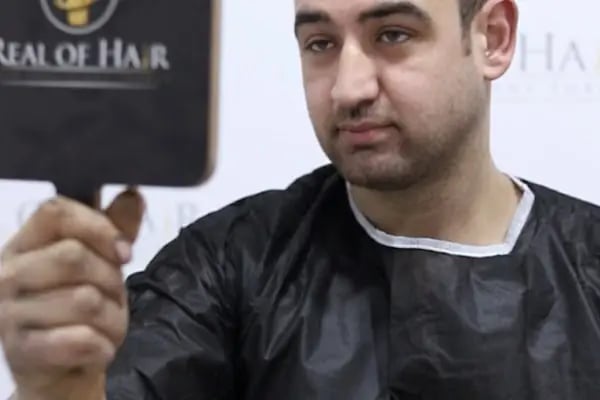 Real Of Hair - Hair Transplant Center in Turkey - Resim 16