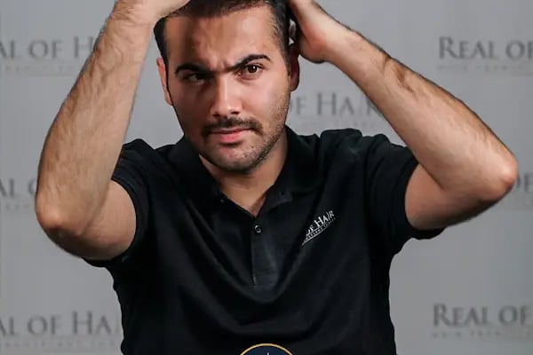 Real Of Hair - Hair Transplant Center in Turkey - Resim 17